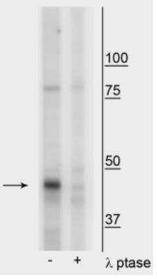Western Blot: Creatine kinase MT 1A [p Tyr153] Antibody [NBP2-60776]